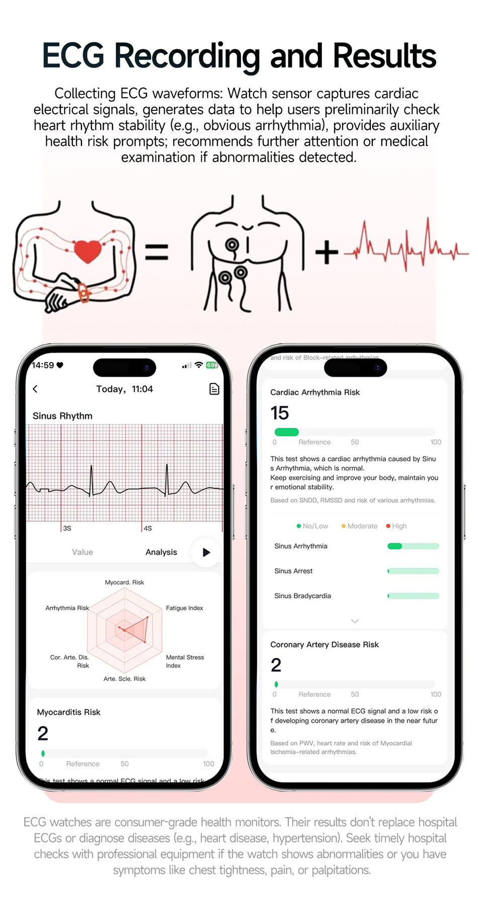 2026 Original Women Health Accurate Diagnosis Smart Watch ECG+HRV BP Blood Oxygen Uric Acid Heart Rate Bluetooth Call Smartwatch