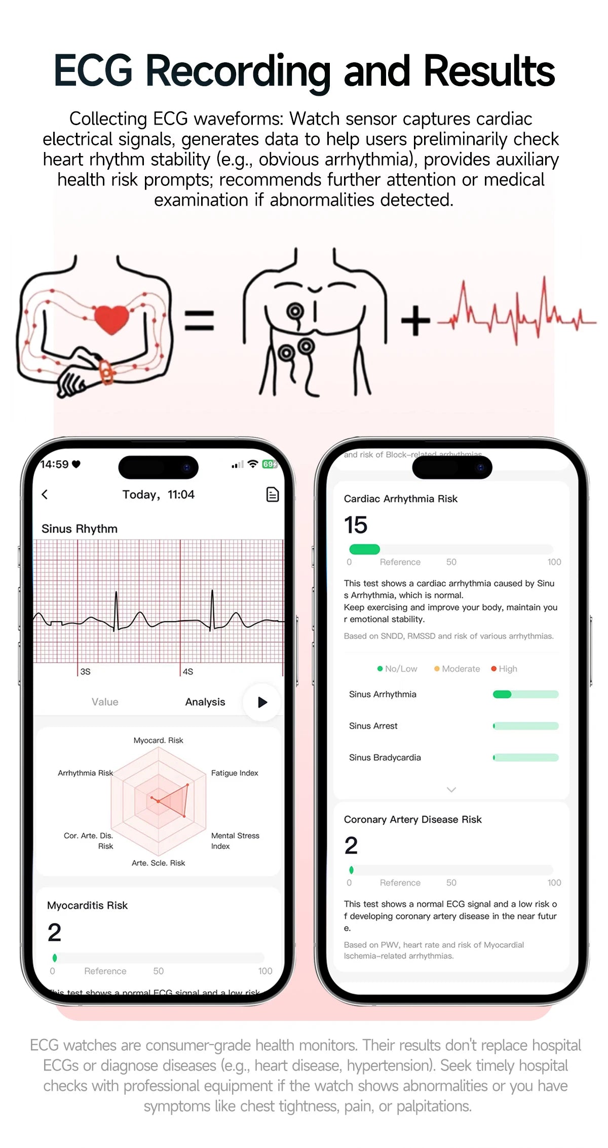 2026 New Nursing Grade Health Analysis SmartWatch ECG+PPG