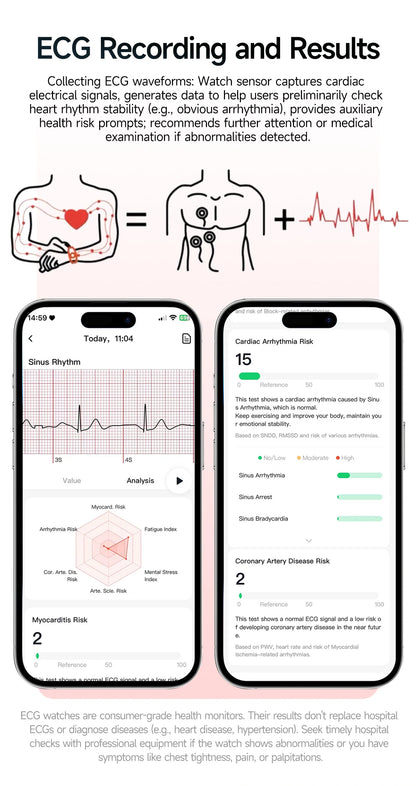 2026 New Nursing Grade Health Analysis SmartWatch ECG+PPG